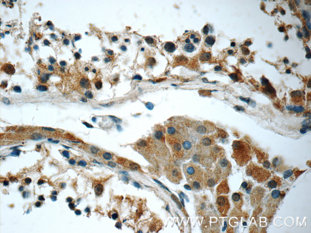 13480-1-AP;human testis tissue