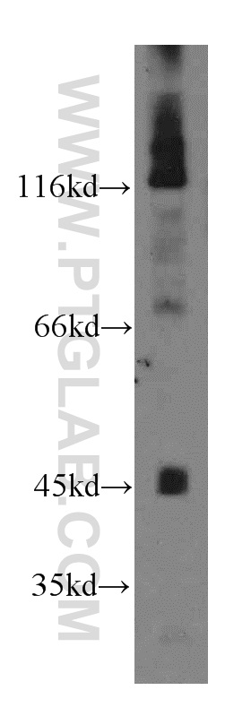 13480-1-AP;mouse skeletal muscle tissue