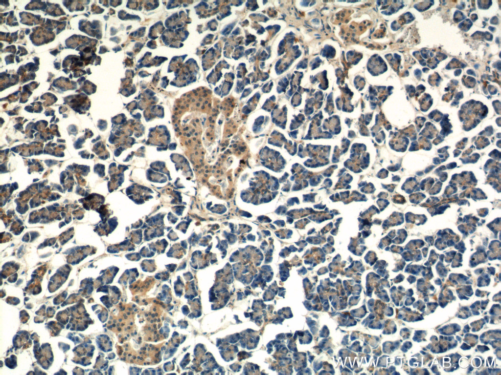 13998-1-AP;human pancreas tissue