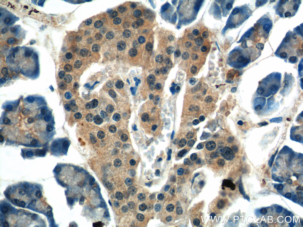 13998-1-AP;human pancreas tissue