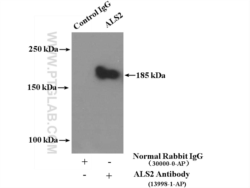 13998-1-AP;HEK-293 cells