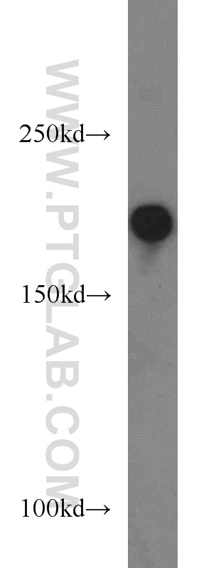 13998-1-AP;HEK-293 cells