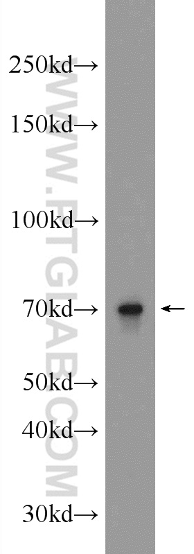 22358-1-AP;mouse testis tissue