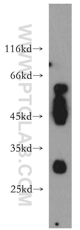 21302-1-AP;HL-60 cells