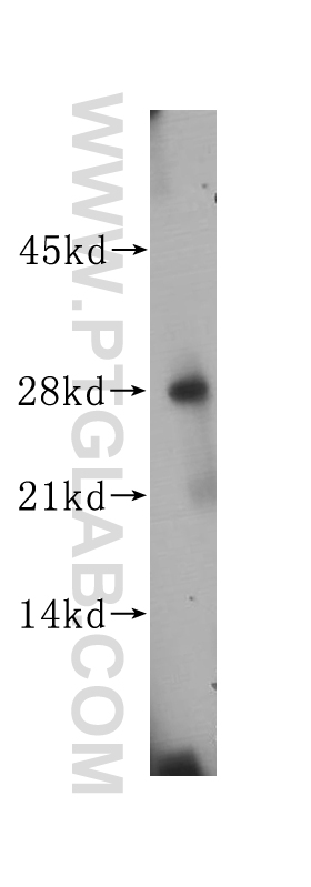 14694-1-AP;human colon tissue