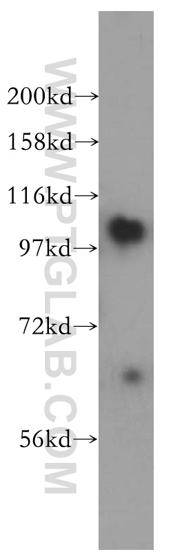 15710-1-AP;human liver tissue