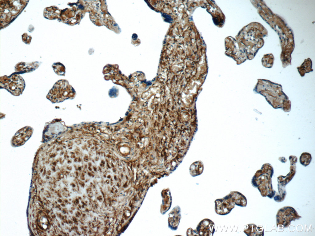 23997-1-AP;human placenta tissue