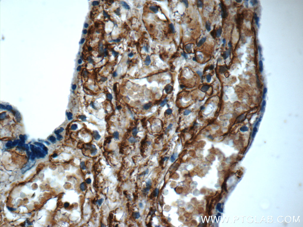 23997-1-AP;human placenta tissue