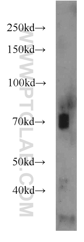 23997-1-AP;mouse kidney tissue