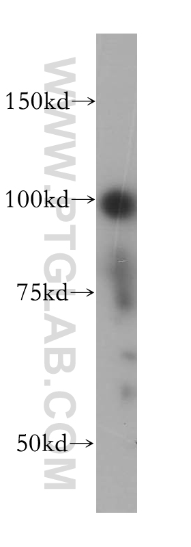 13559-1-AP;MCF7 cell