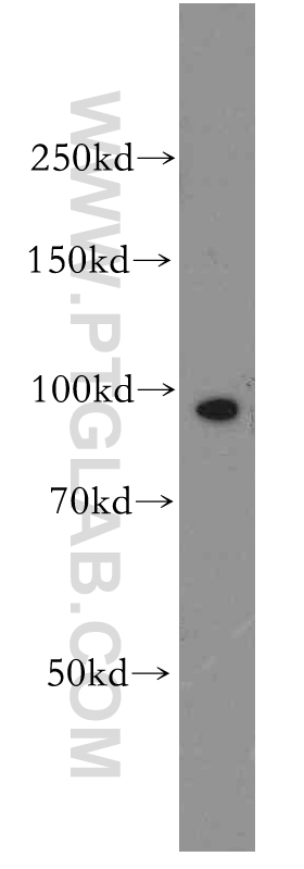 14129-1-AP;human brain tissue