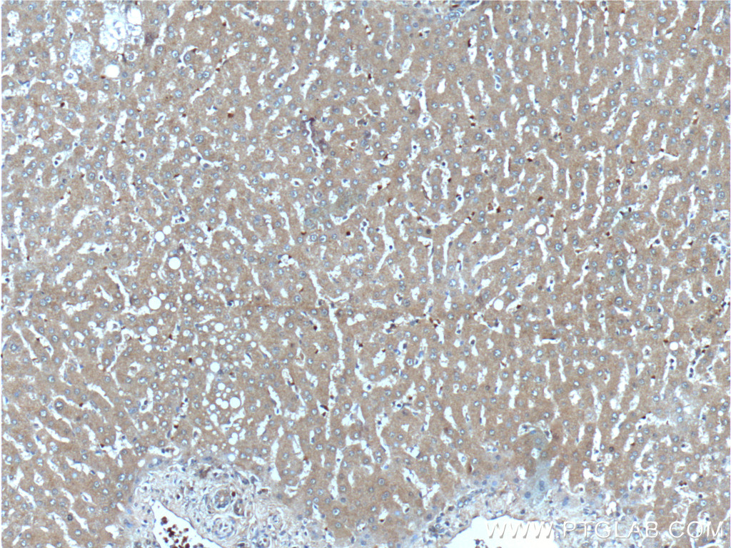 18302-1-AP;human liver tissue