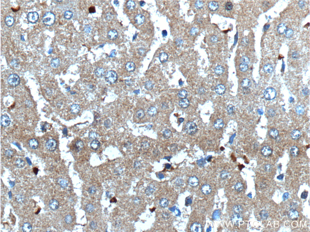 18302-1-AP;human liver tissue