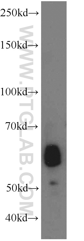 12316-1-AP;mouse small intestine tissue