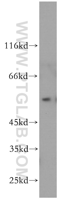 11964-1-AP;A375 cell