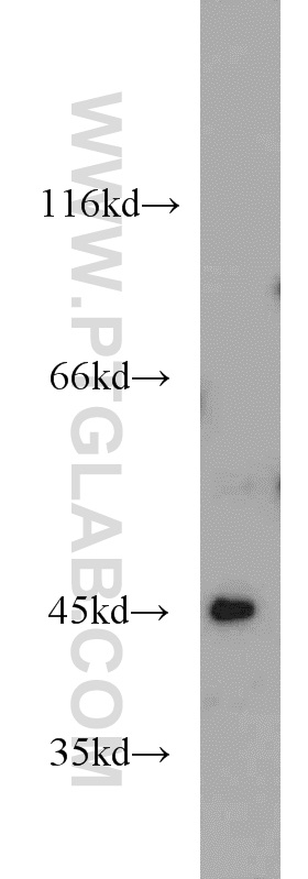 10396-1-AP;MCF7 cell