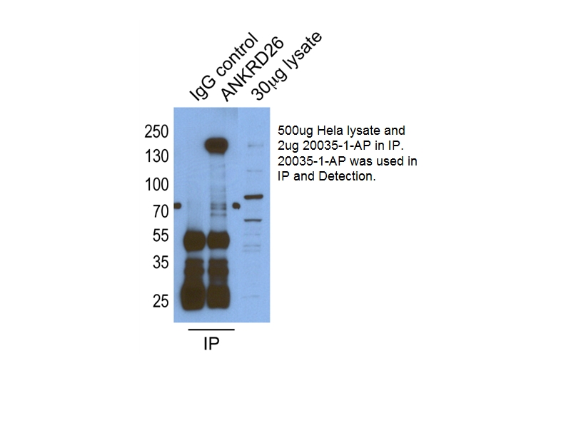 20035-1-AP;HeLa cells