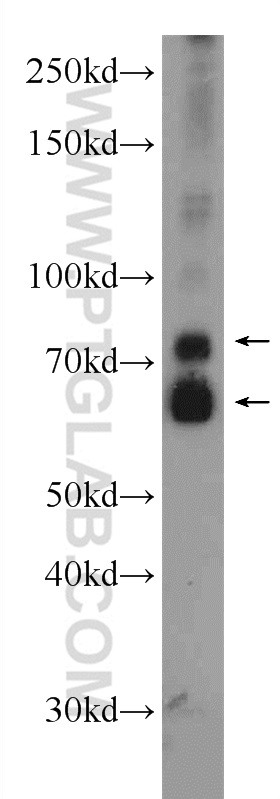 24058-1-AP;mouse liver tissue