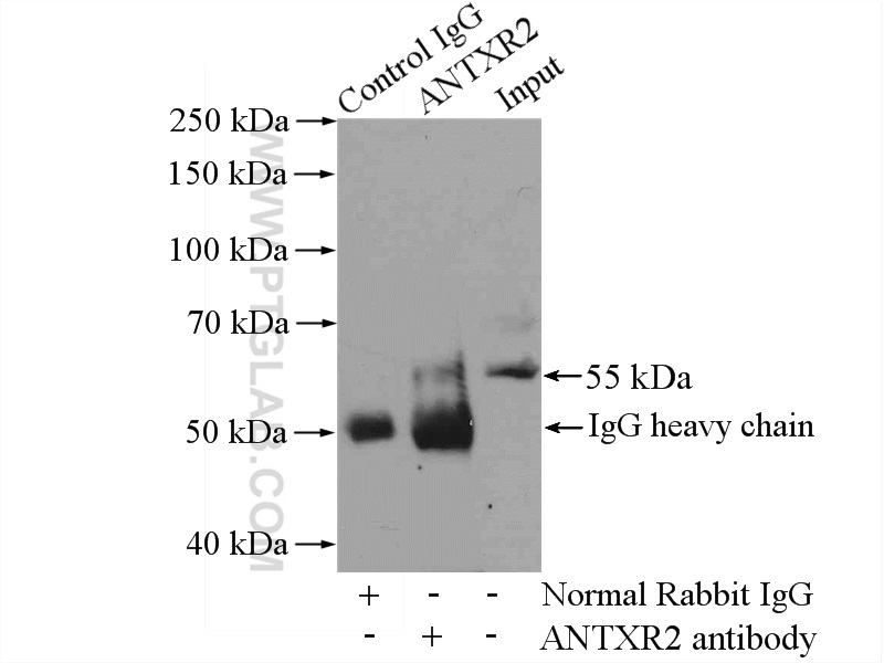 16723-1-AP;HEK-293 cells