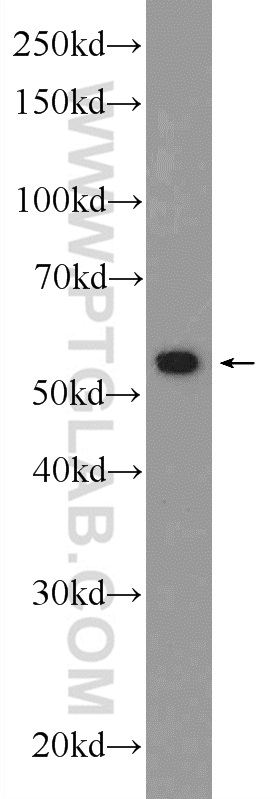 16723-1-AP;HEK-293 cells