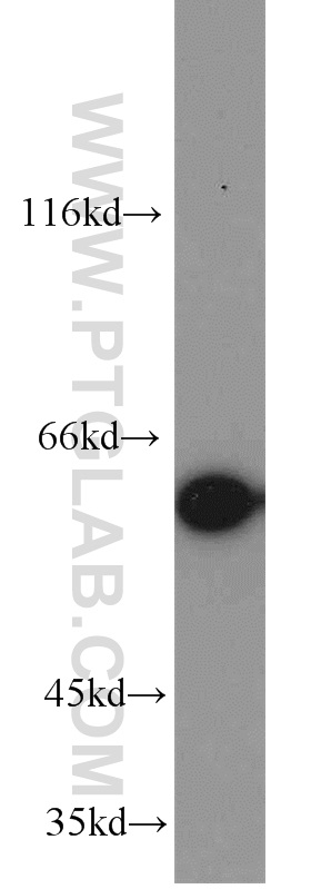 10479-2-AP;HeLa cells