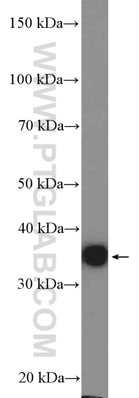 11804-1-AP;HepG2 cells