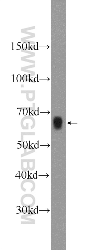 12911-1-AP;mouse colon tissue