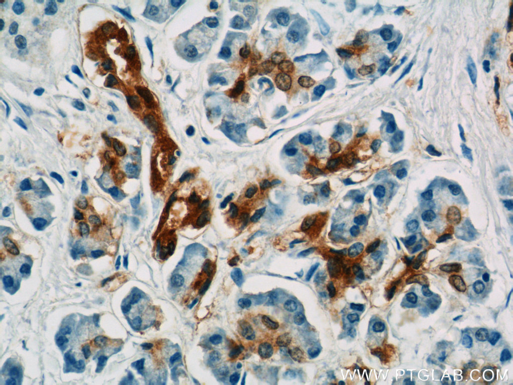 13258-1-AP;human pancreas cancer tissue