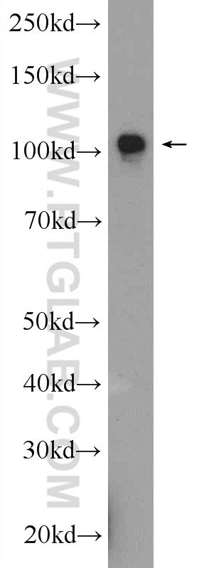 15722-1-AP;mouse brain tissue