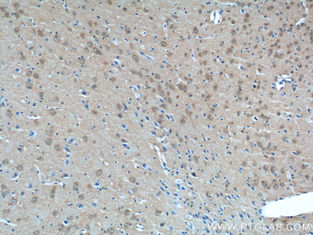 11925-1-AP;mouse brain tissue