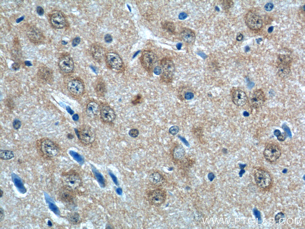 11925-1-AP;mouse brain tissue