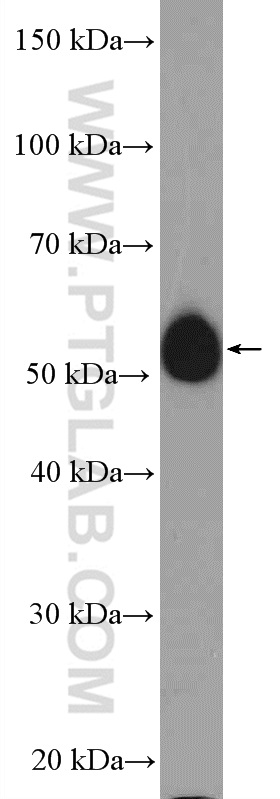 11653-1-AP;mouse heart tissue