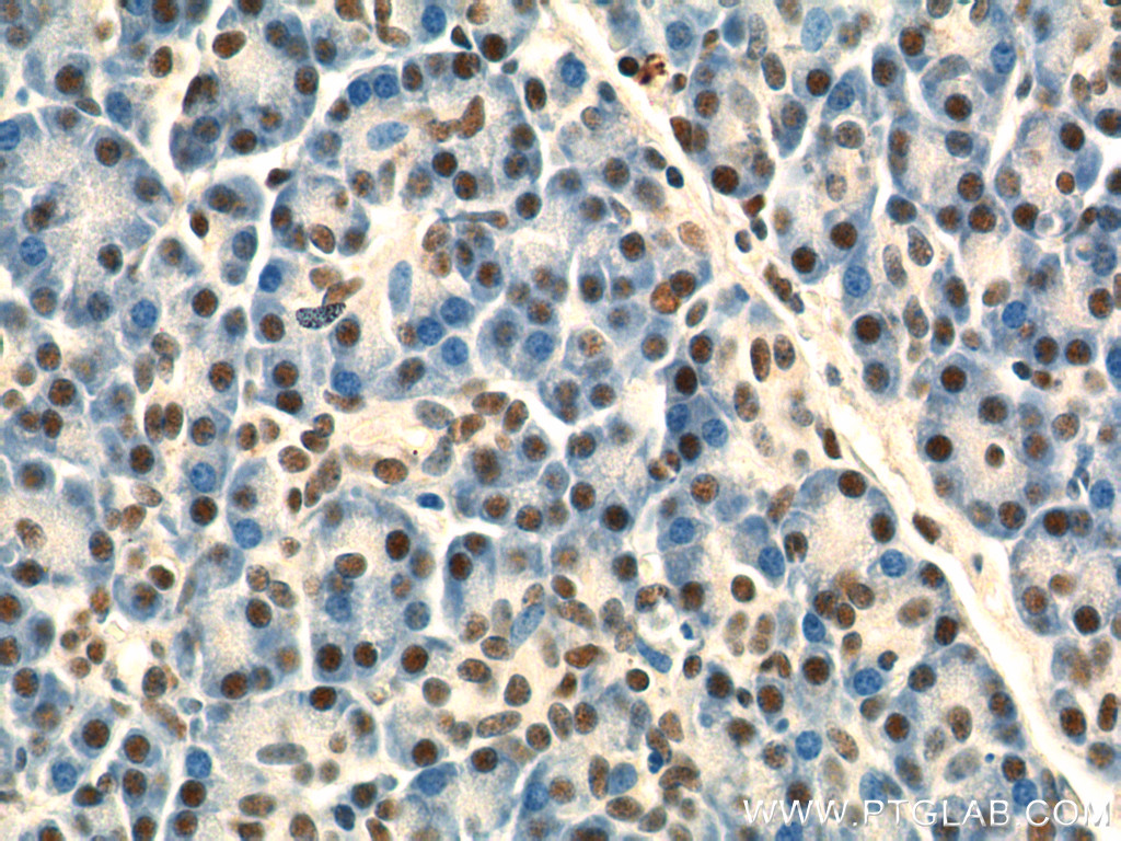 25689-1-AP;human pancreas tissue