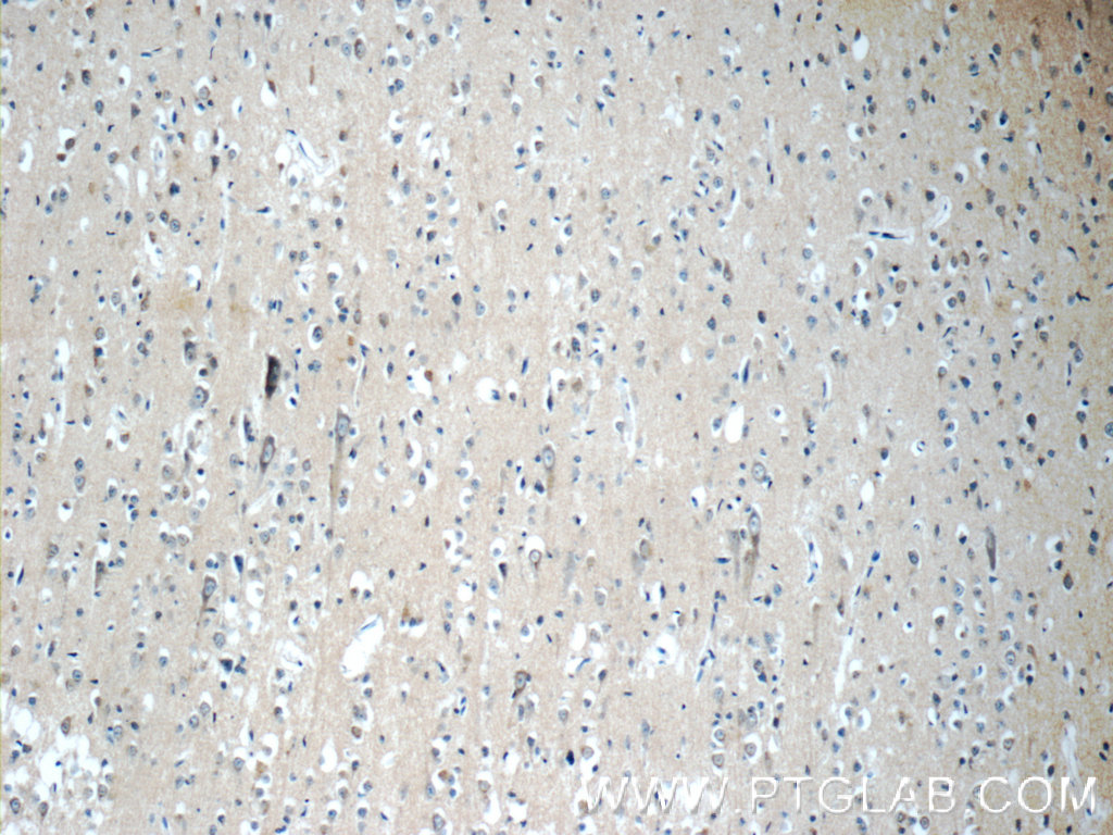 12305-2-AP;human brain tissue