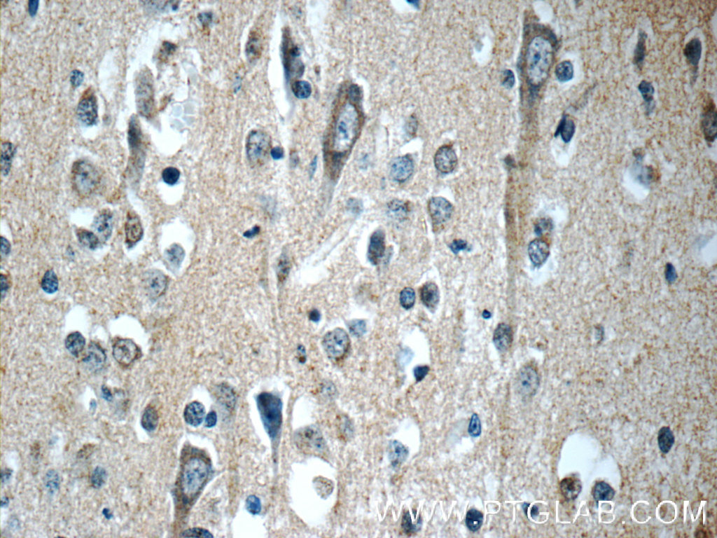 12305-2-AP;human brain tissue