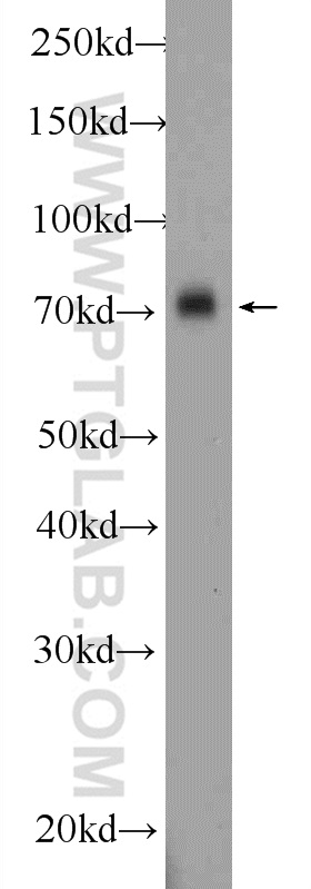 12305-2-AP;mouse brain tissue