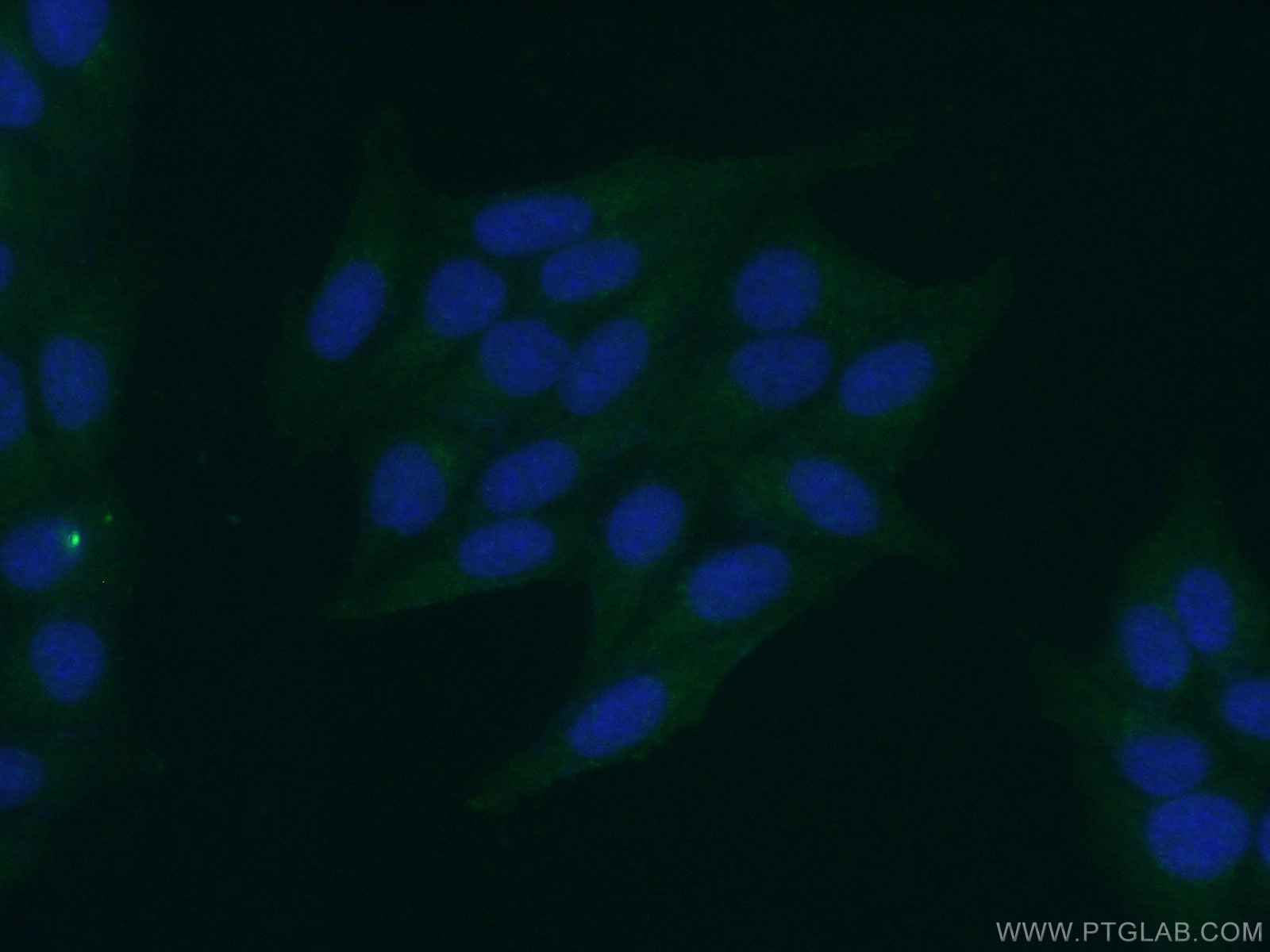 20578-1-AP;HepG2 cells