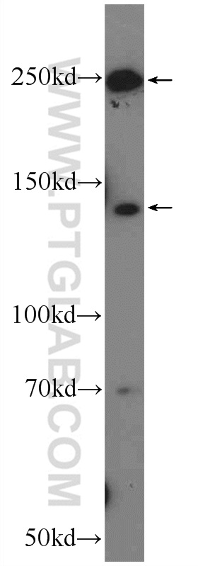 20578-1-AP;mouse liver tissue