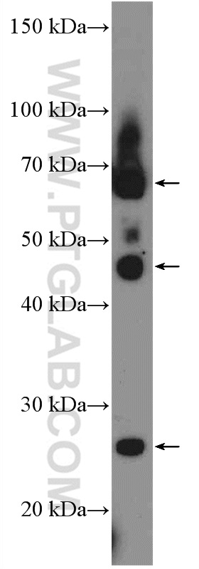 14559-1-AP;MDA-MB-453s cells