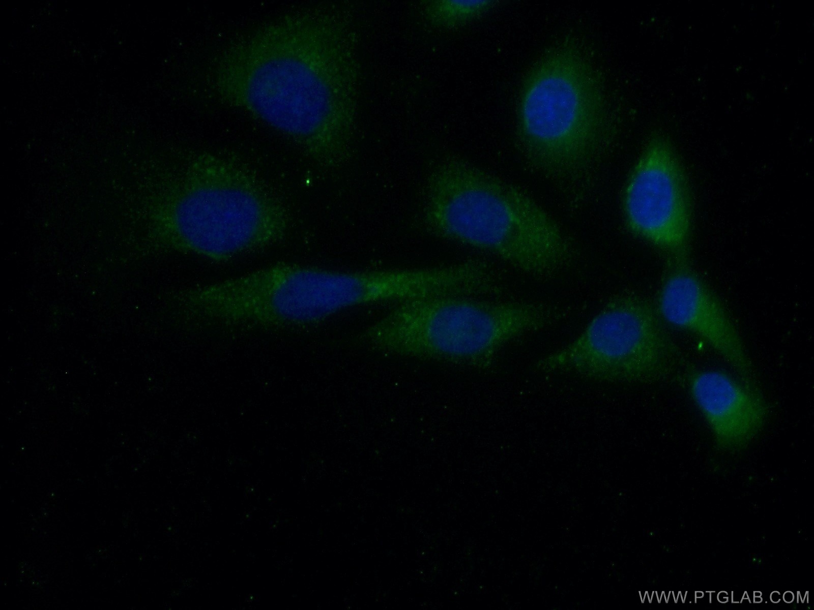 10591-1-AP;SKOV-3 cells