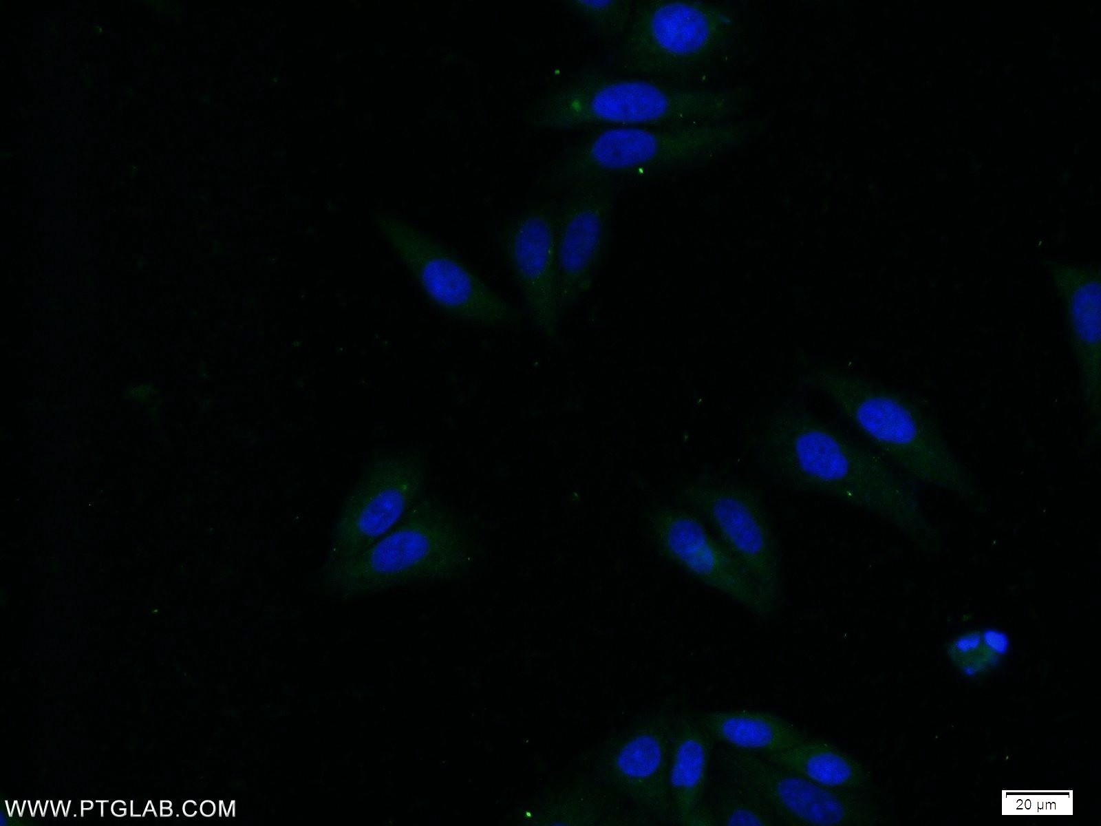 16530-1-AP;HepG2 cells