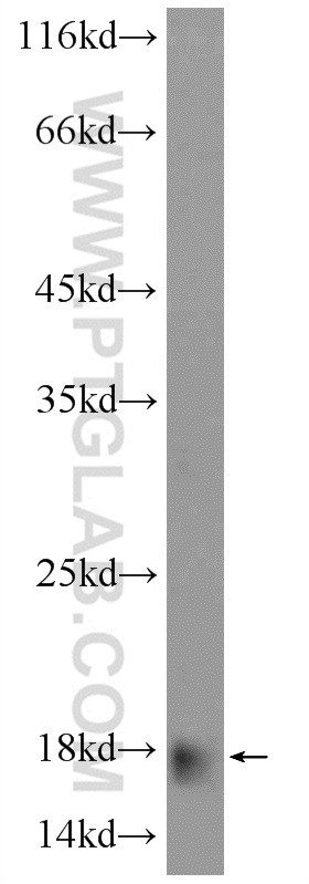 16530-1-AP;human plasma tissue