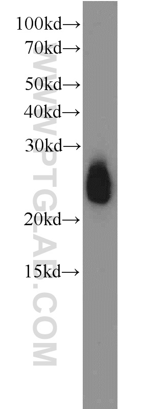 10520-1-AP;human serum tissue