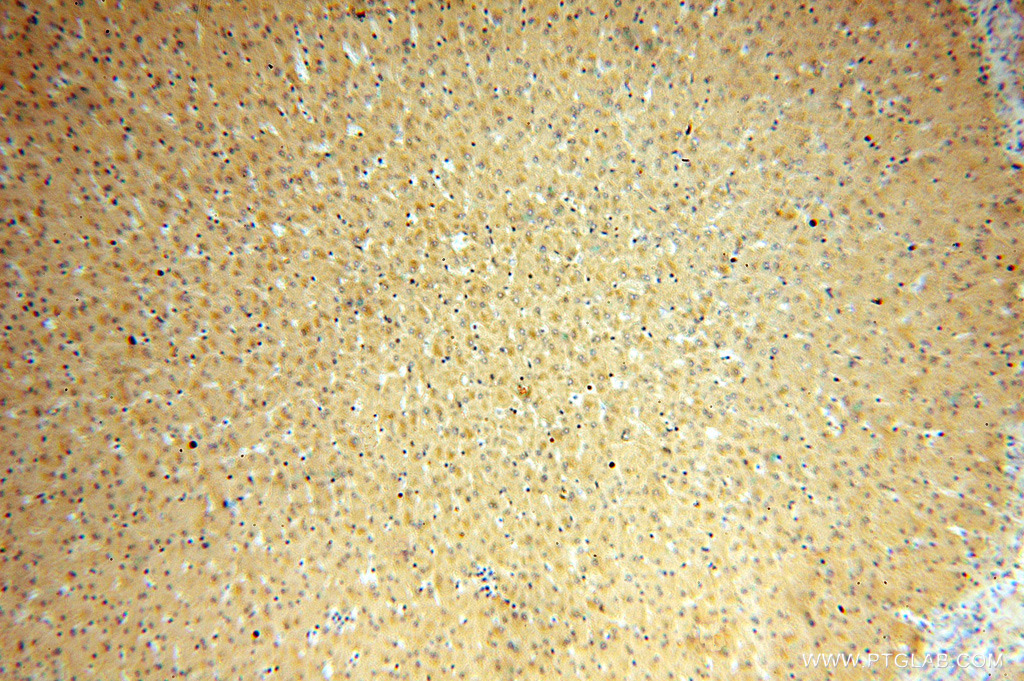 16608-1-AP;human liver