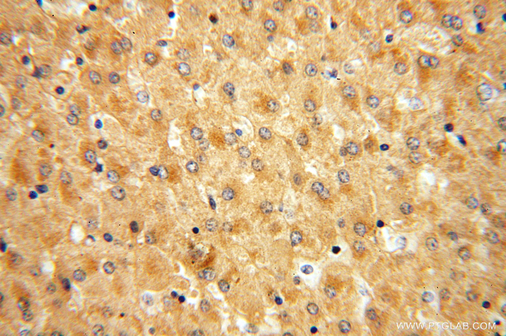 16608-1-AP;human liver