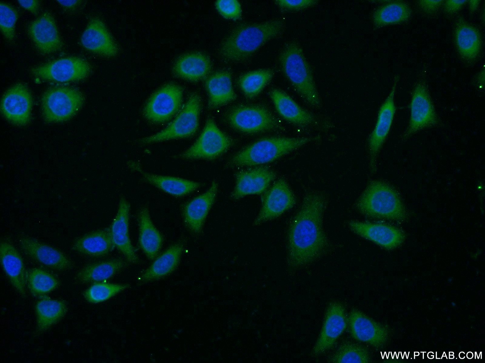 25925-1-AP;HeLa cells