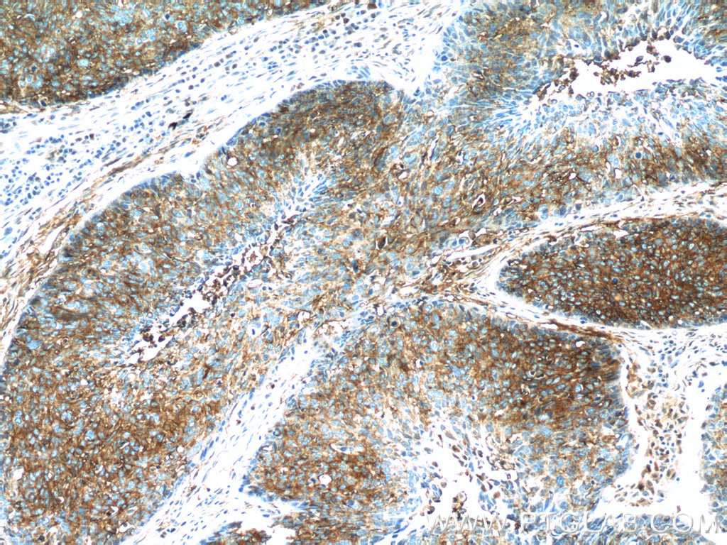 25925-1-AP;human lung cancer tissue