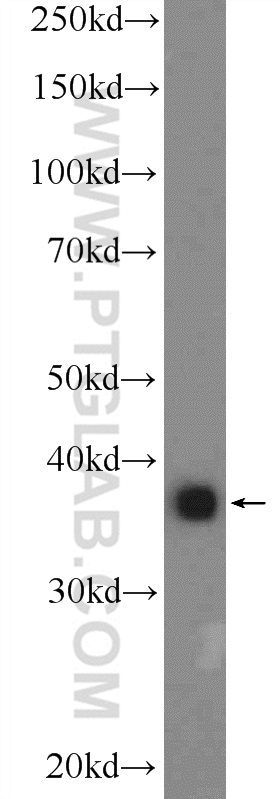 25925-1-AP;A549 cells