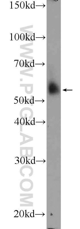 10564-1-AP;human placenta tissue