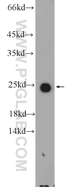 12817-1-AP;human plasma tissue